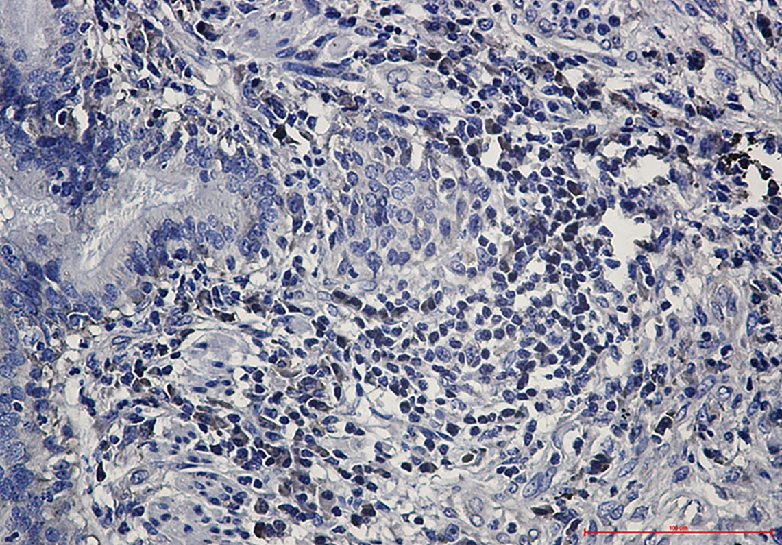 EIF1AX Antibody