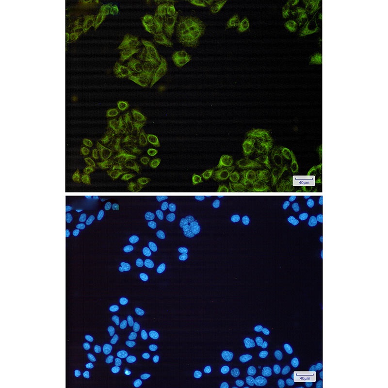 EGFR Antibody