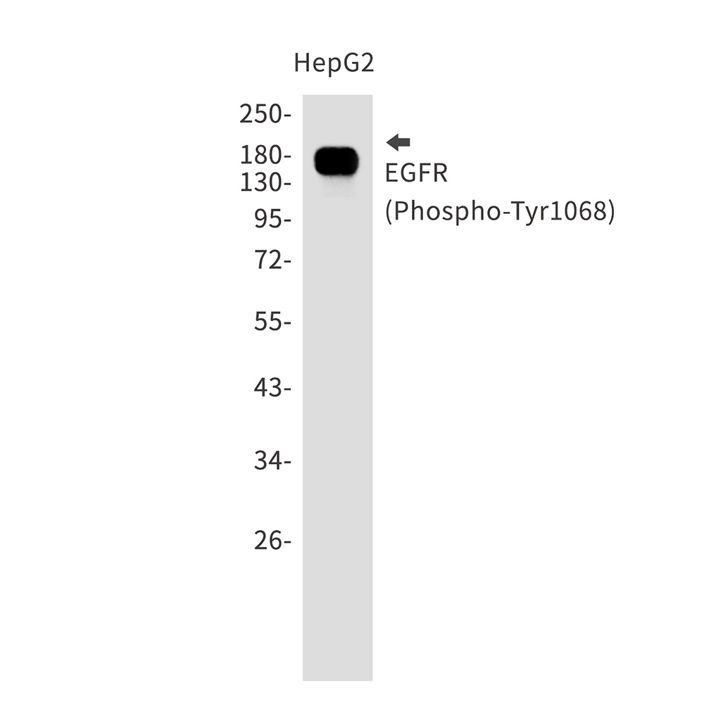 Phospho-EGFR (Tyr1068) Rabbit mAb