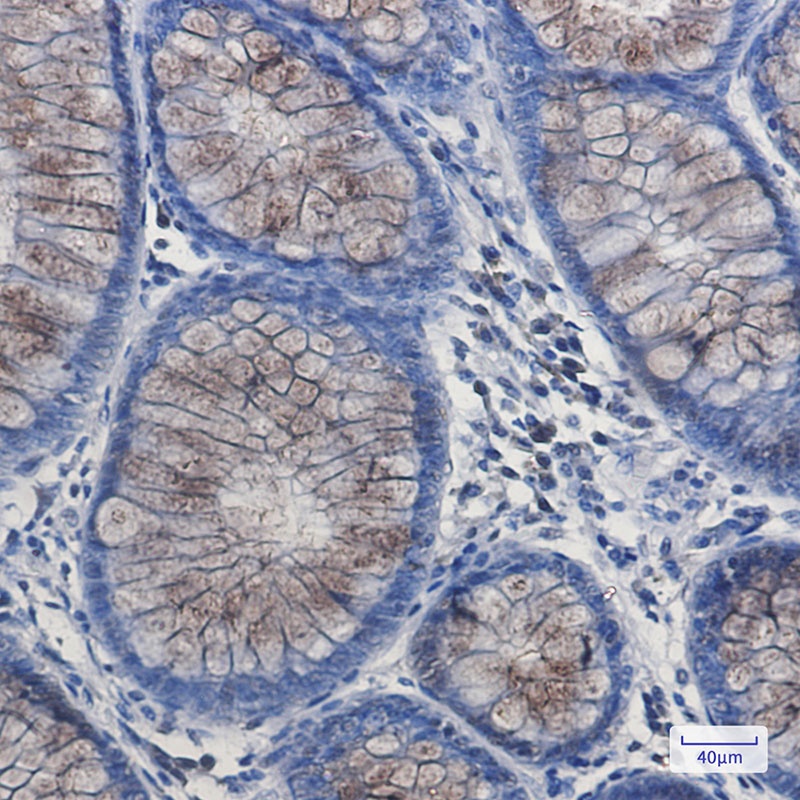 DYNLL1 Rabbit mAb