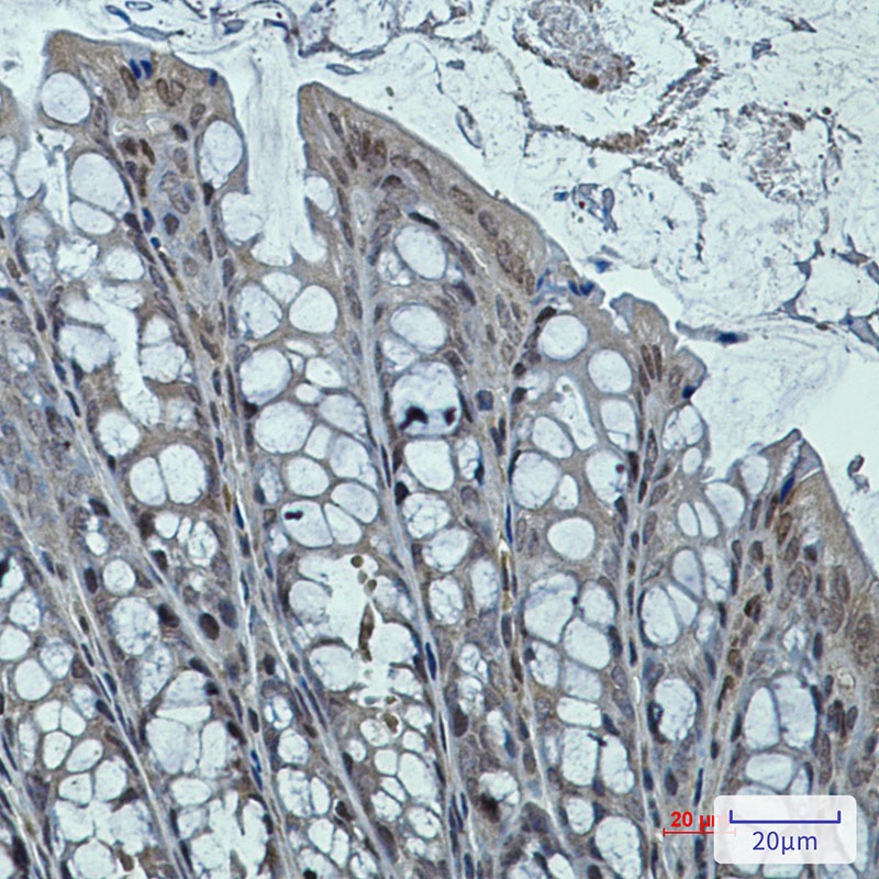 DNAJB6 Antibody