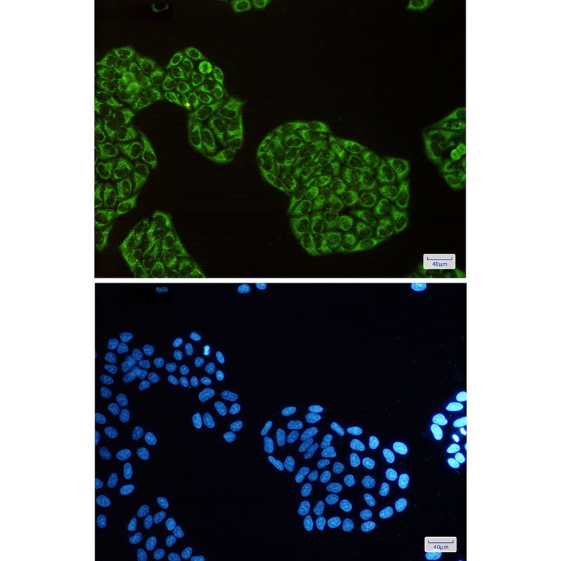 DISC1 Antibody