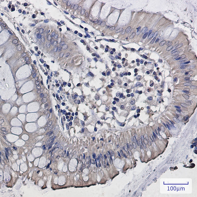 DISC1 Antibody
