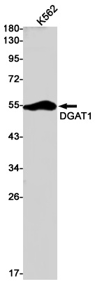 DGAT1 Antibody