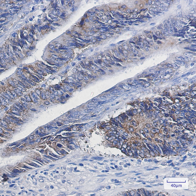 DGAT1 Rabbit mAb