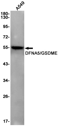 GSDME Antibody