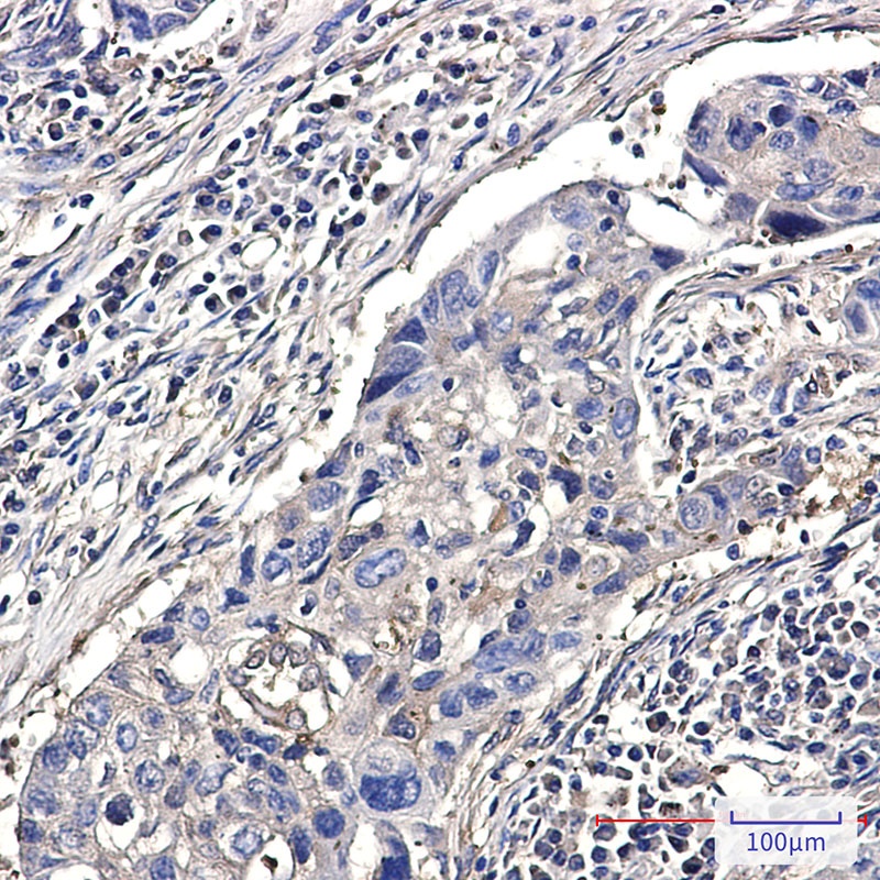 DSTN Antibody