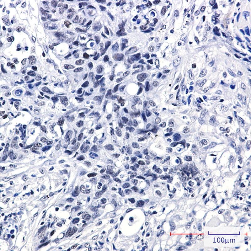 DEK Antibody