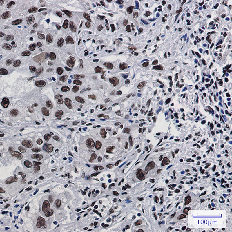 DDX5 Antibody