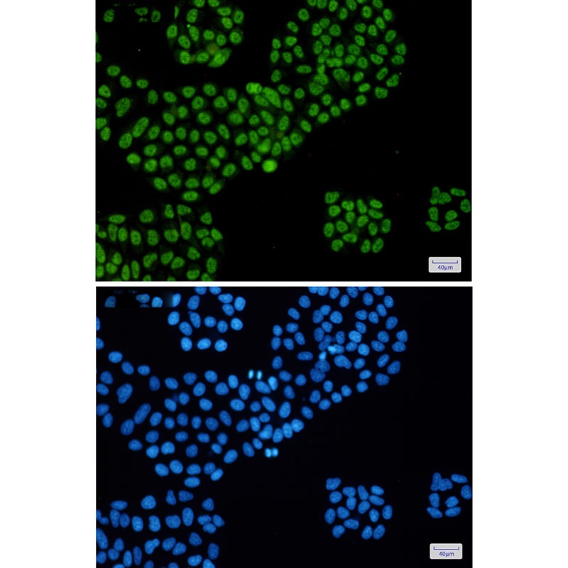 DDX5 Antibody