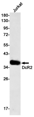 DcR2 Rabbit mAb