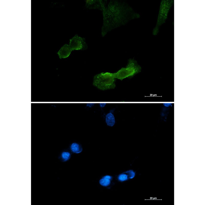 [KD] DCAMKL1 Rabbit mAb