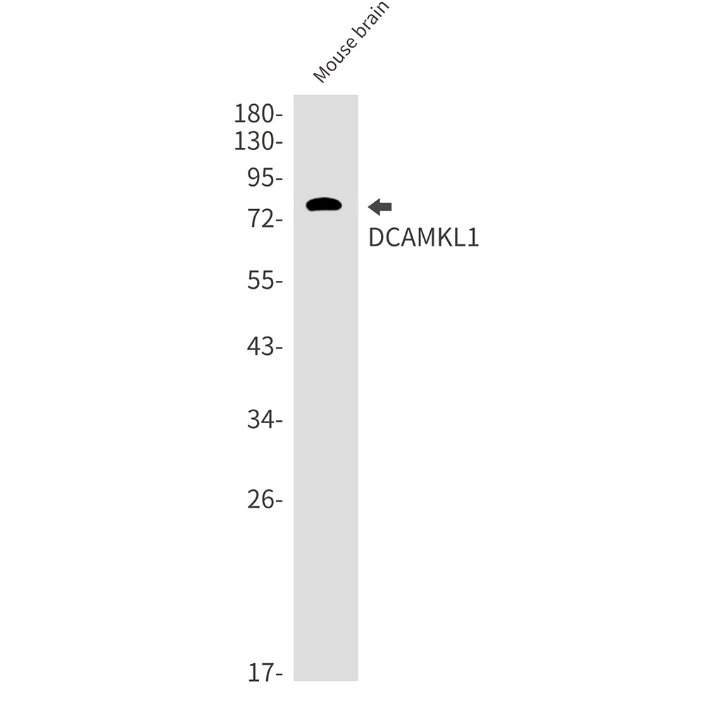 [KD] DCAMKL1 Rabbit mAb