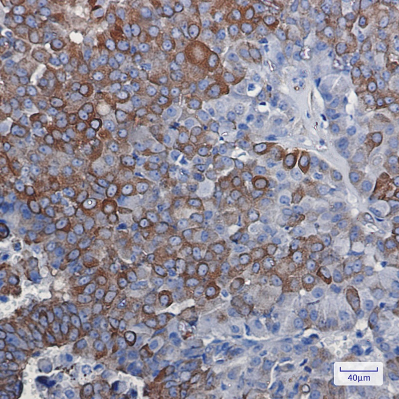 [KD] DCAMKL1 Rabbit mAb