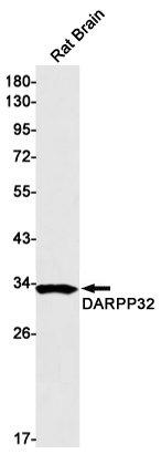 [KD] DARPP32 Rabbit mAb