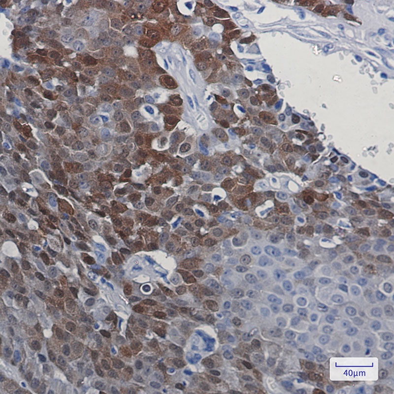 [KD] DARPP32 Rabbit mAb