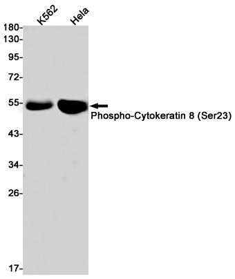 Phospho-Cytokeratin 8 (Ser23) Rabbit mAb
