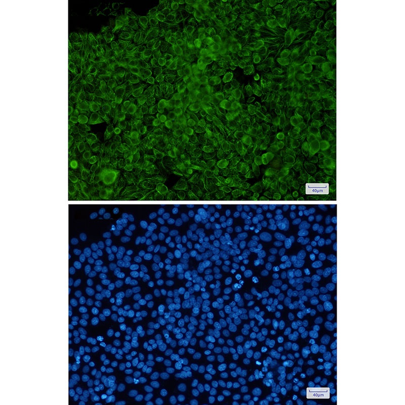 Phospho-Cytokeratin 8 (Ser23) Rabbit mAb