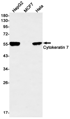 Cytokeratin 7 Rabbit mAb