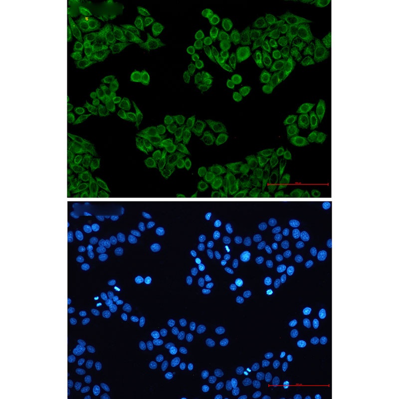 Cytokeratin 7 Rabbit mAb