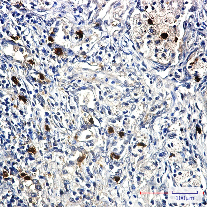Cyclin E2 Rabbit mAb