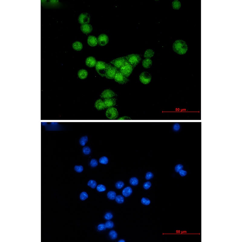 Cyclin E2 Rabbit mAb