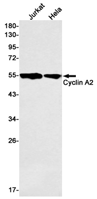 Cyclin A2 Rabbit mAb