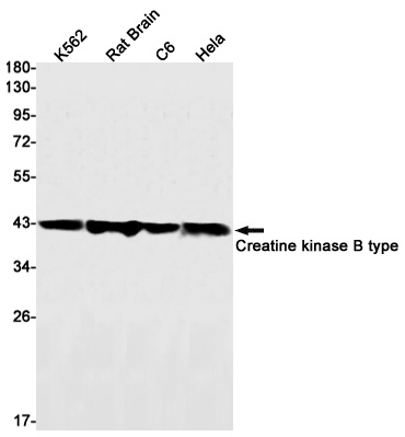 [KD] Creatine Kinase B type Rabbit mAb