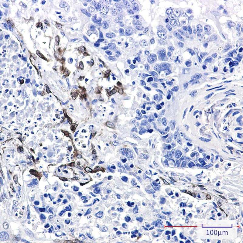 COX2/Cyclooxygenase 2 Rabbit Monoclonal Antibody