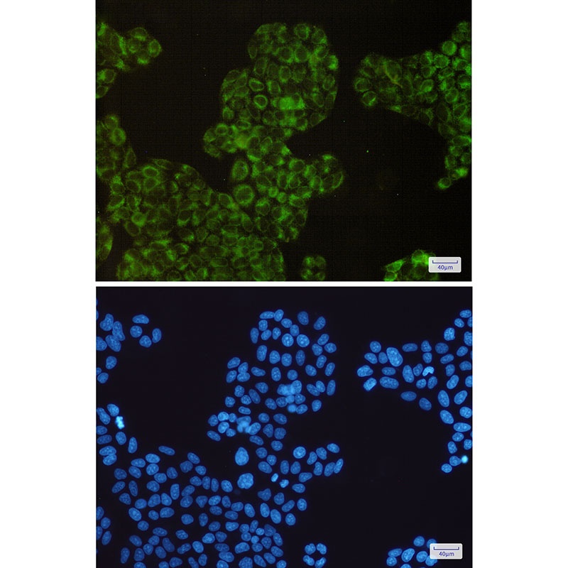 PTGS1 Antibody