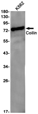 Coilin Rabbit Monoclonal Antibody