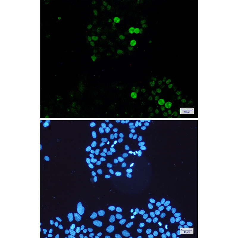 MYC Antibody