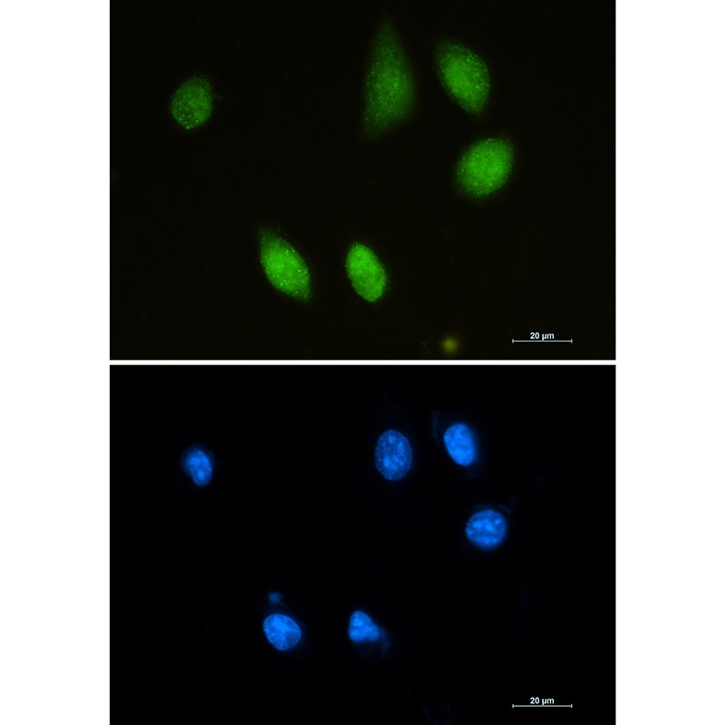 CHAT Antibody