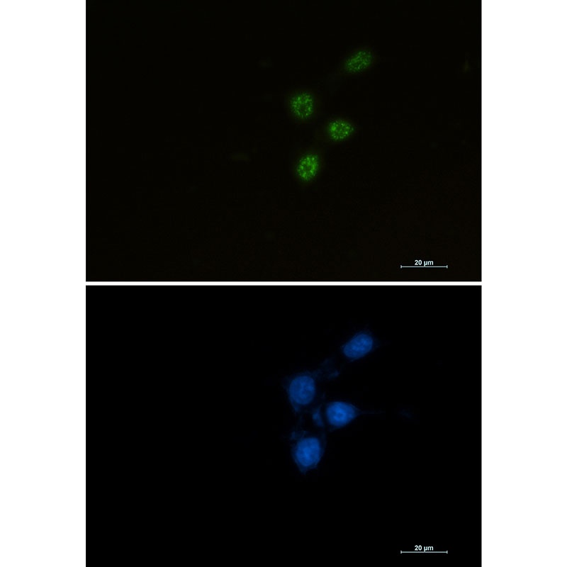 CHEK2 Antibody