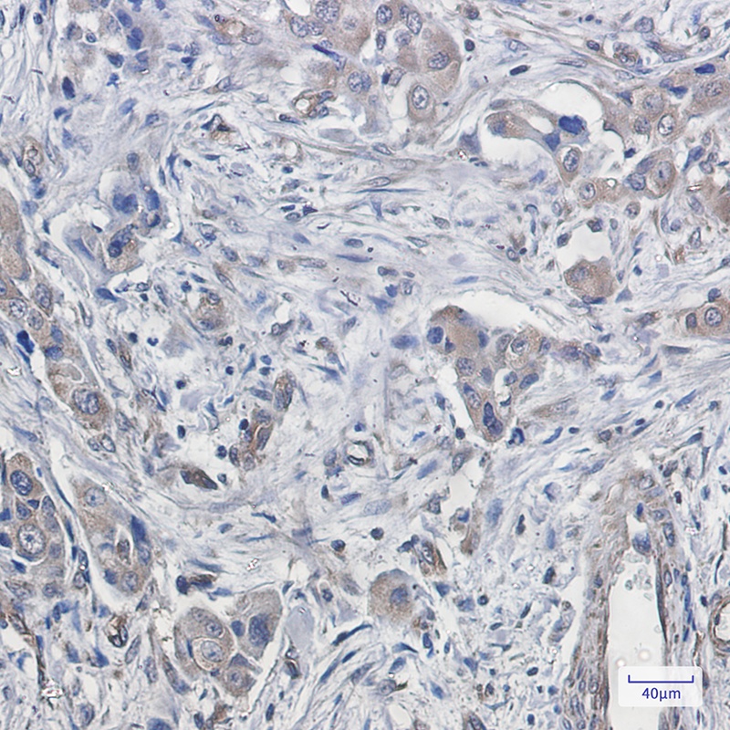 CDT2 Rabbit mAb