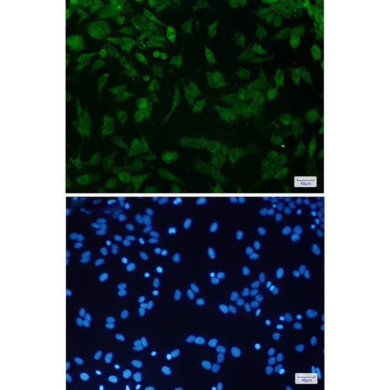 CDKN2A Antibody