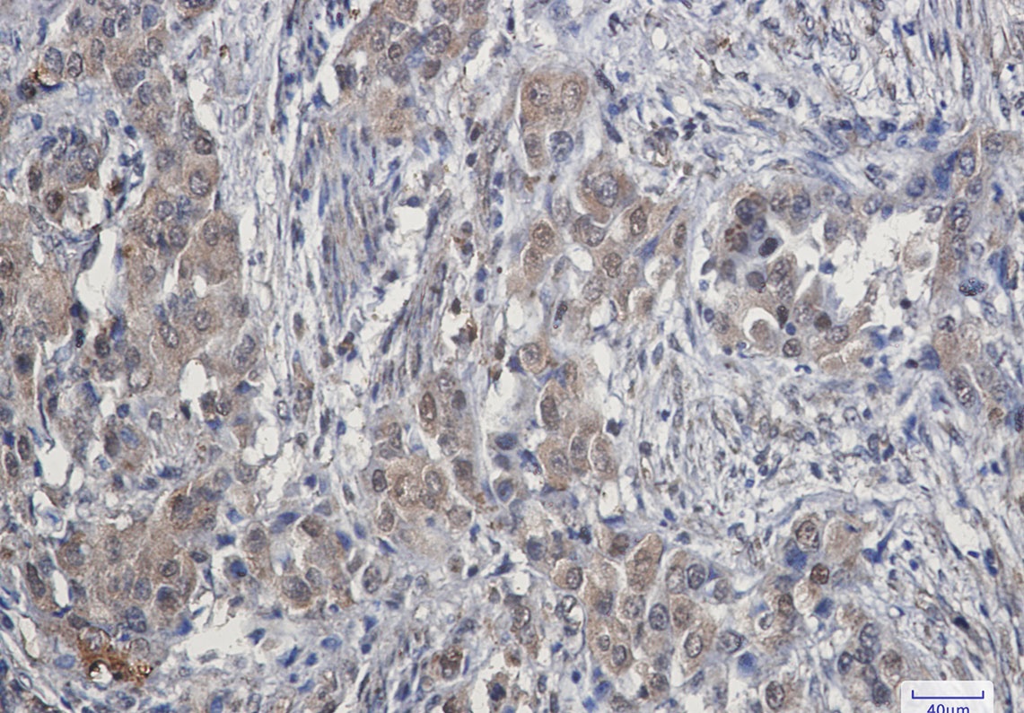 CDK4 Antibody