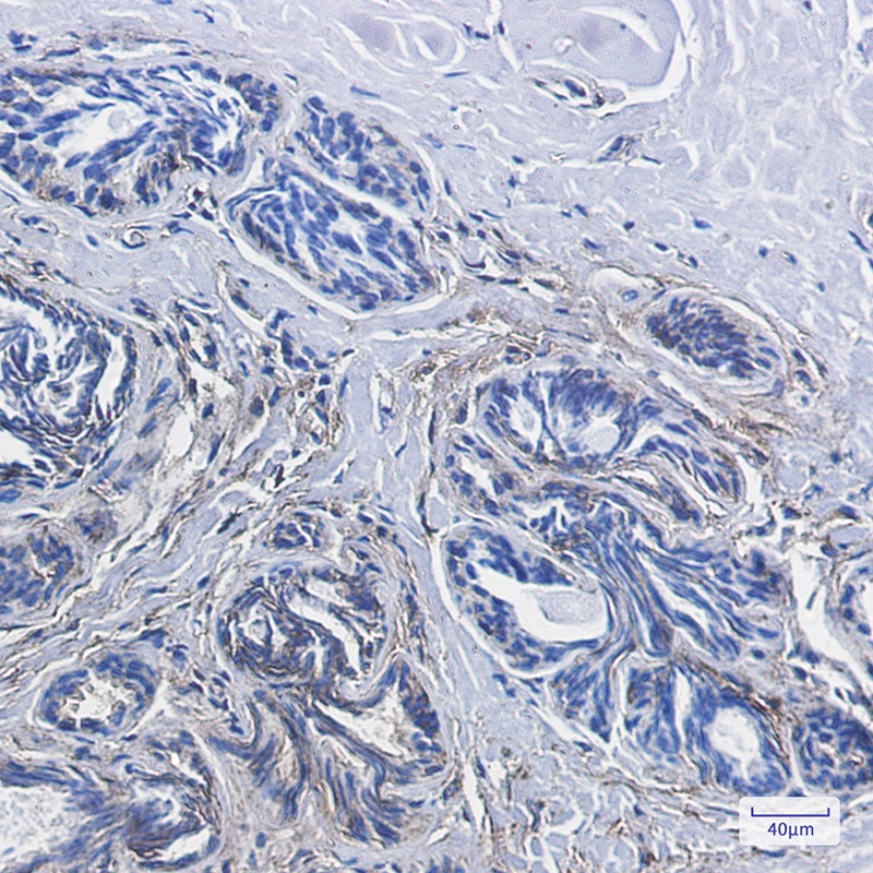 CD99 Rabbit mAb