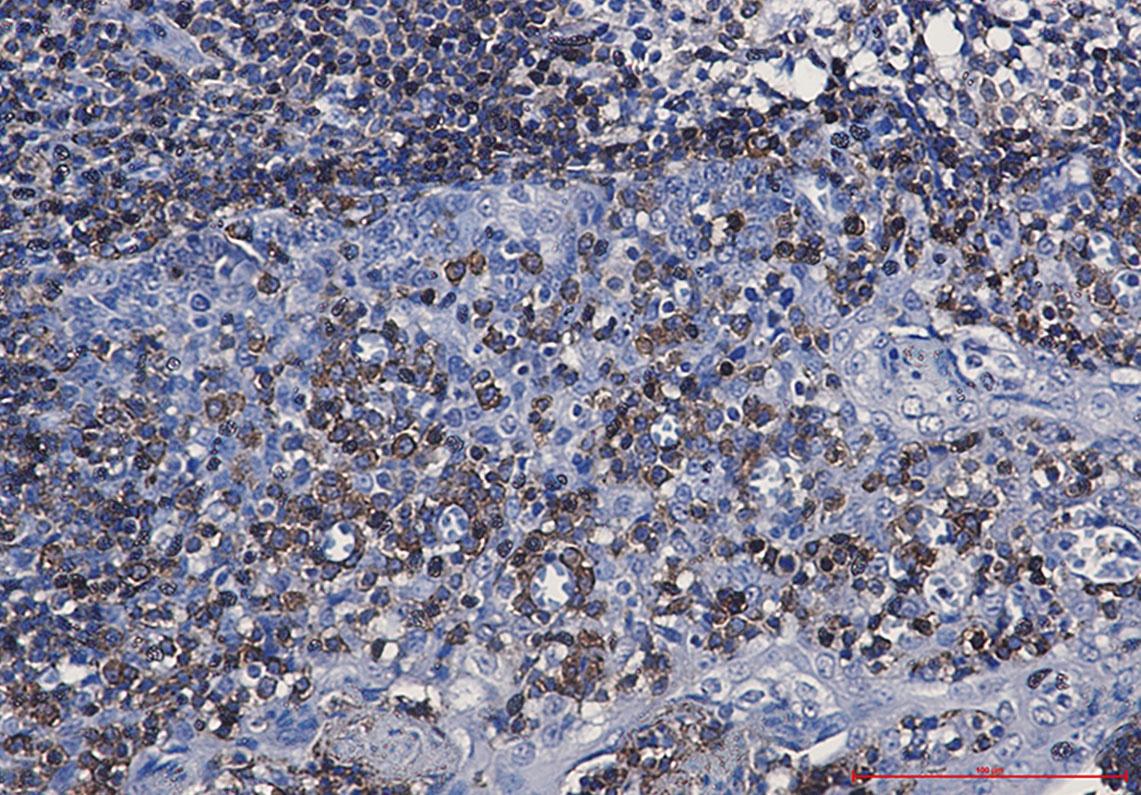 CD79A Antibody