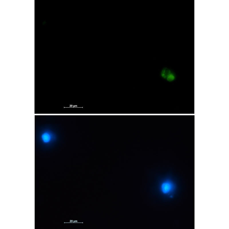 CD22 Antibody
