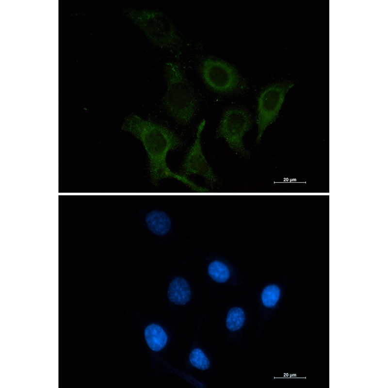 CD166 Rabbit mAb