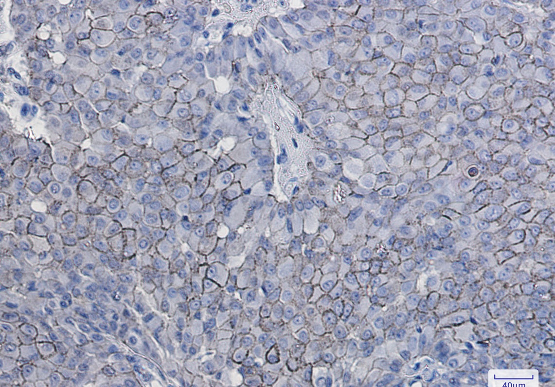 CD166 Rabbit mAb