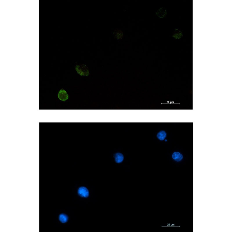 CBL Antibody