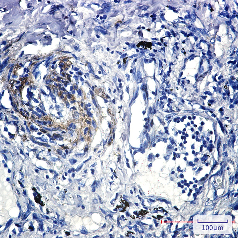 CAV2 Antibody