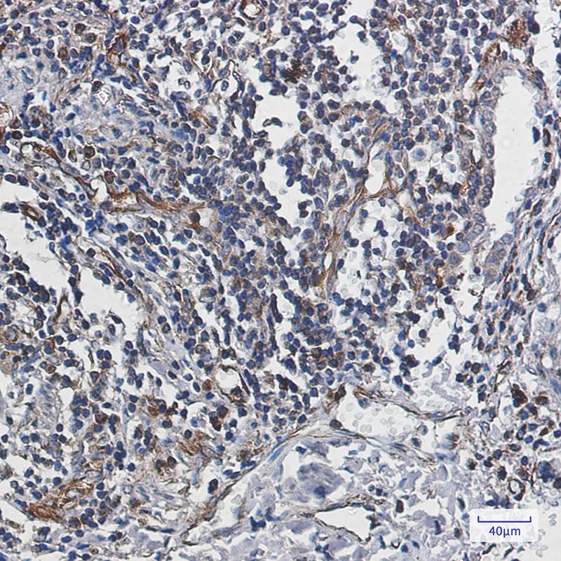 Caspase 10 Rabbit mAb