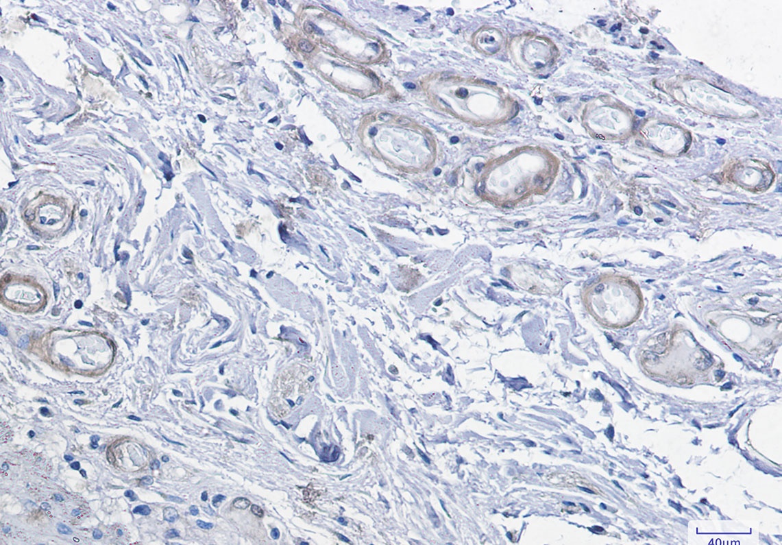 [KD] cAMP Protein Kinase Catalytic Subunit Rabbit mAb