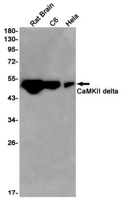 CaMKII delta Rabbit Monoclonal Antibody