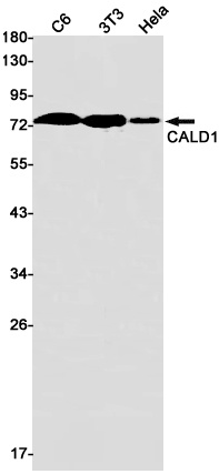 [KO] Caldesmon Rabbit mAb