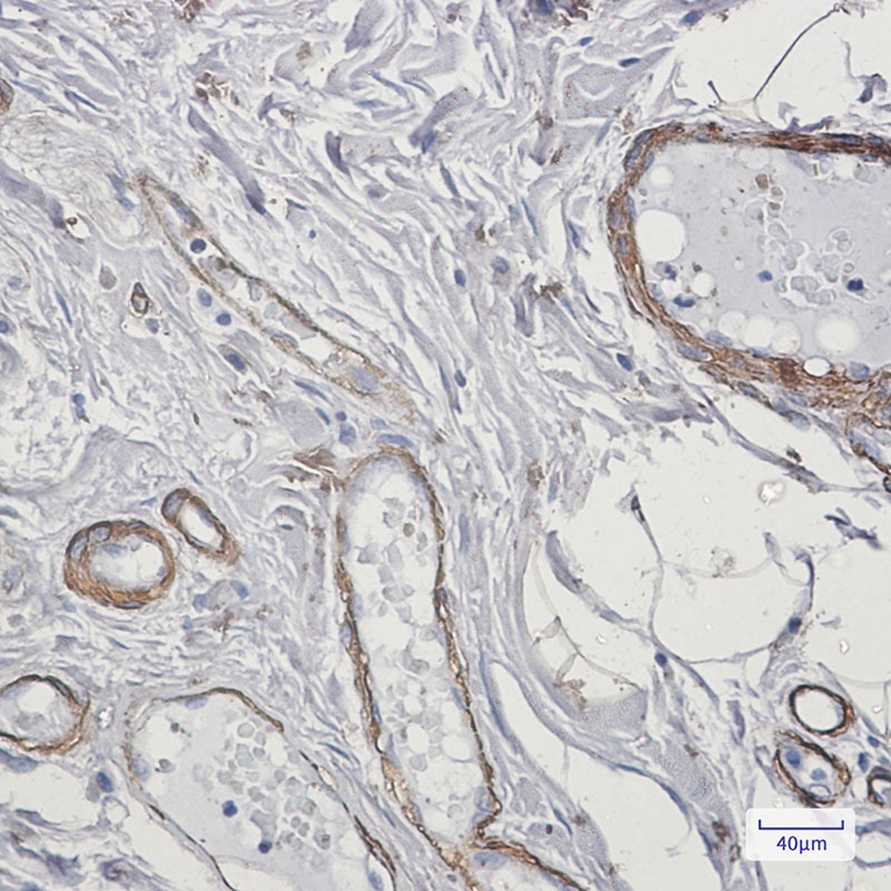 CALD1 Antibody