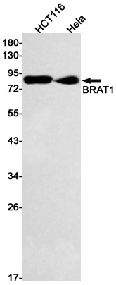 BRAT1 Rabbit mAb